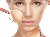 anti-ageing treatments Gold Coast