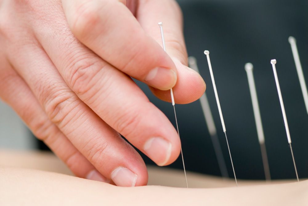 acupuncture treatment gold coast