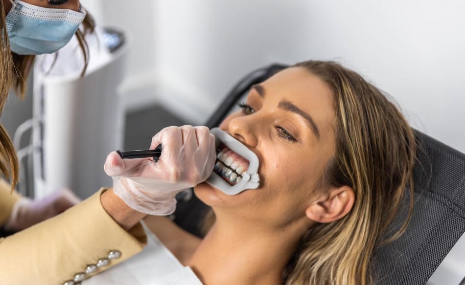 Teeth Whitening in Gold Coast